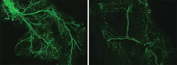 Brain activation extends the life of mice