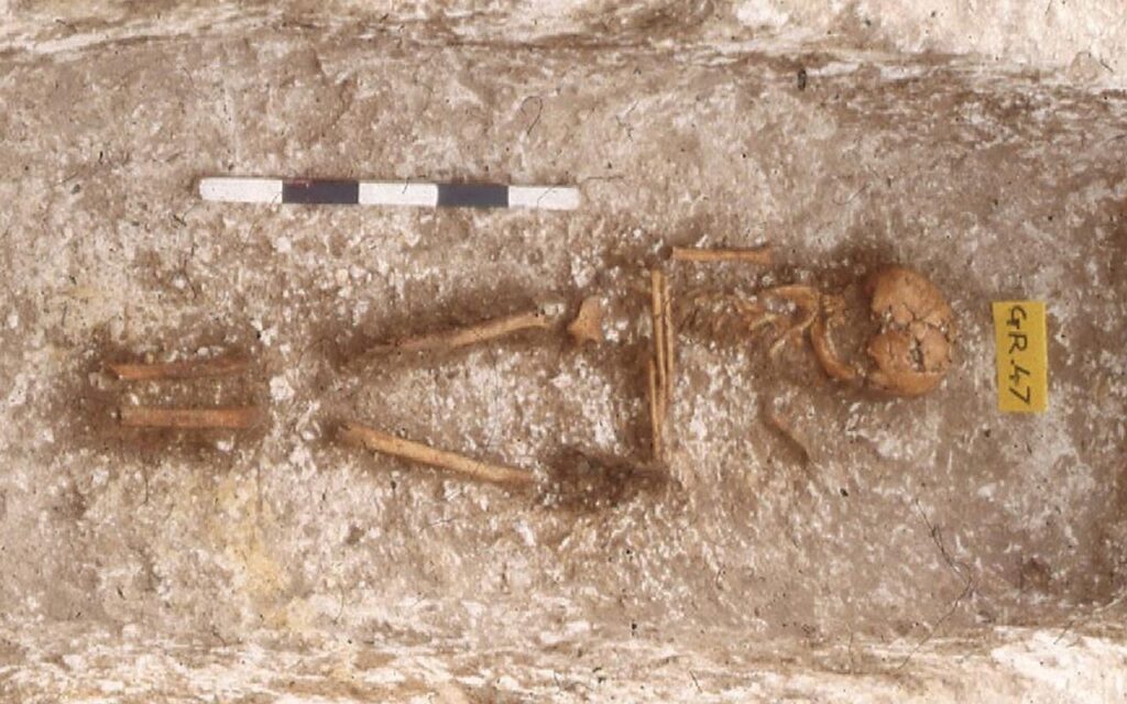Esqueleto da garota com ascendência da África Ocidental enterrada em Updown, Kent. Crédito: Duncan Sayer et al., *Antiquity* (2025). CC BY 4.0
