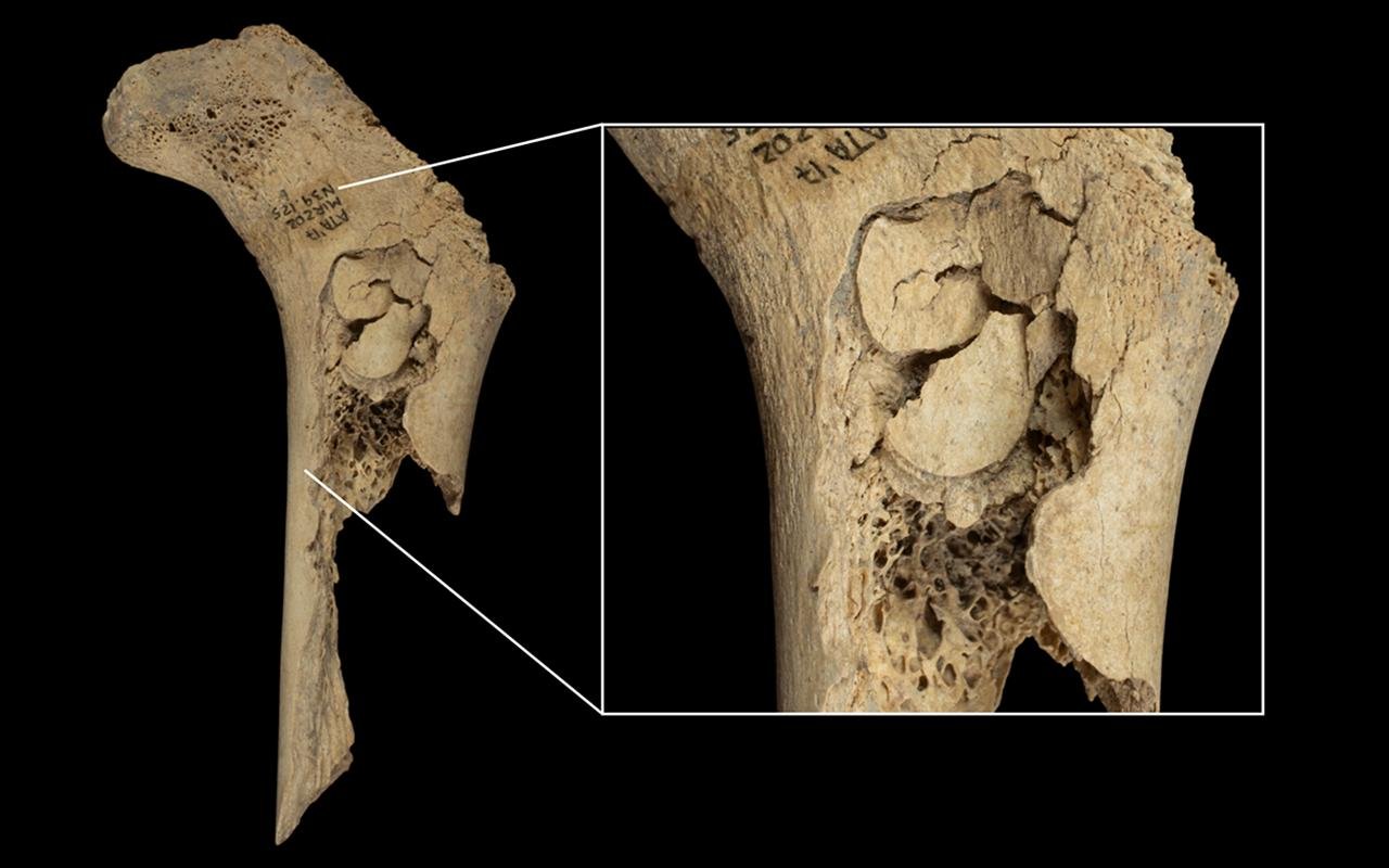 Canibalismo de 5.700 anos ligado à violência neolítica descoberta na caverna El Mirador na Espanha