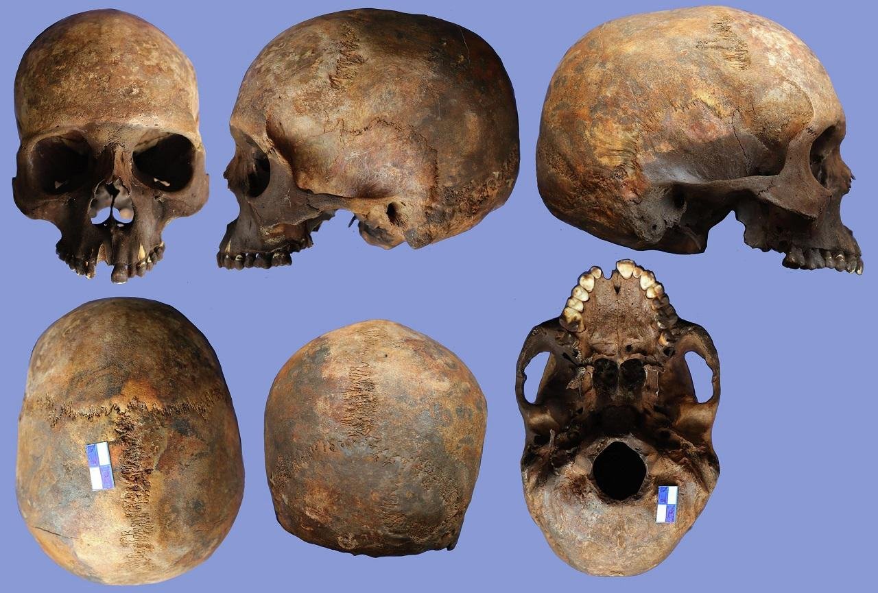 As vítimas de terremoto do século IV em Heraclea Sintica revelam cuidados de deficientes no mundo romano