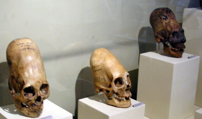 Análise de DNA em crânios alongados não descarta origem extraterrestre
